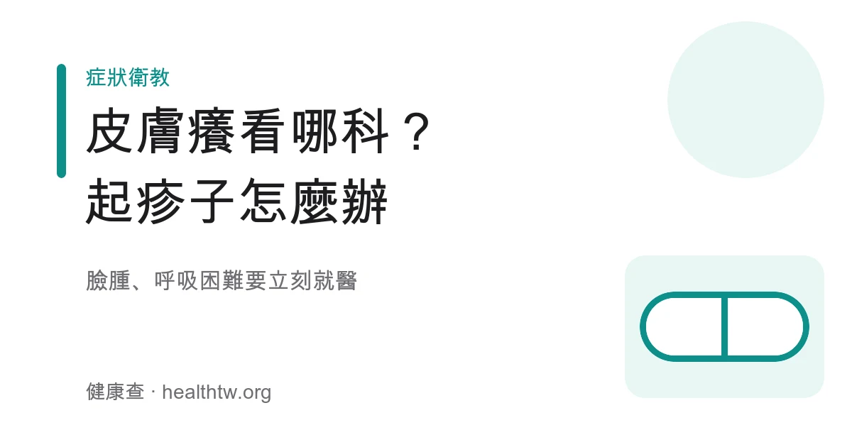 皮膚癢起疹子看哪科與過敏警訊示意圖
